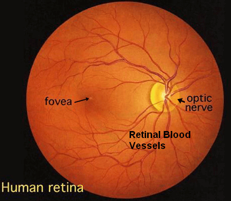 Retinal-blood-vessels-appearance - Asheville Optometrists & Eyewear ...